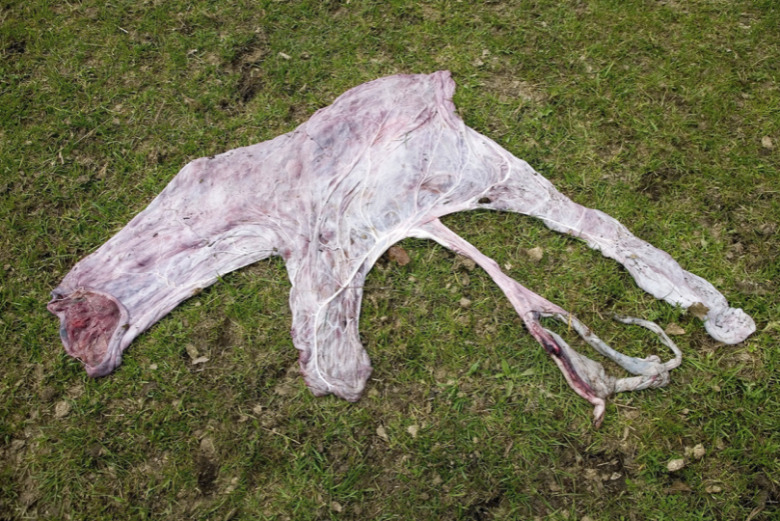 Förlossningsfång svårt att häva